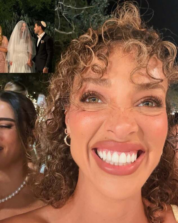 לעד ניהיה מהופנטים מהשיניים שלה  (צילום: Eden Fines אינסטגרם)