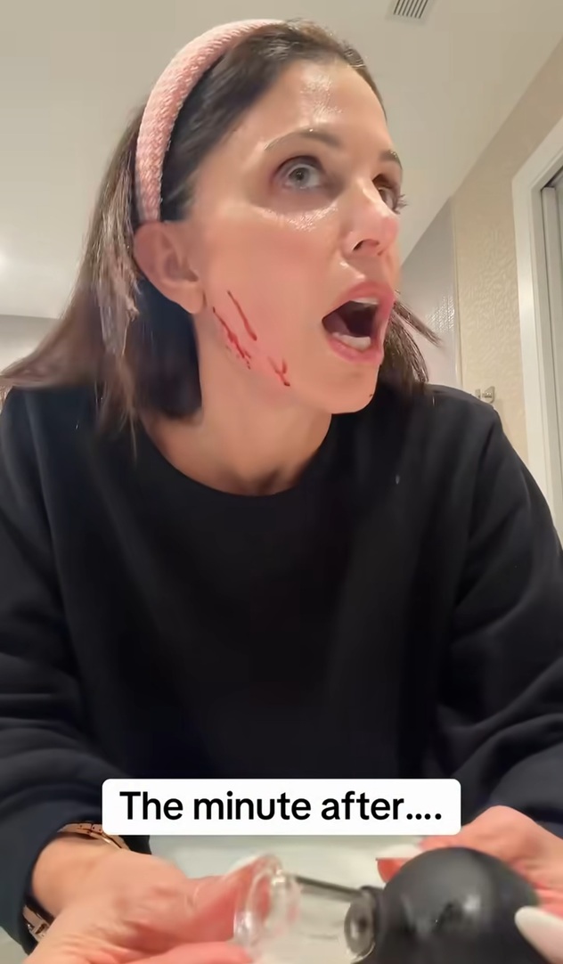 יופי מסוכן (צילום: אינסטגרם, bethennyfrankel)