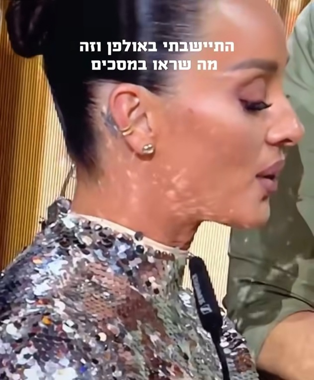 ואז התגלתה התקלה (צילום: אינסטגרם, aronovanna)